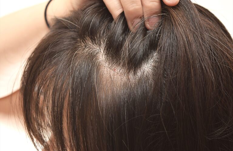 早めの薄毛対策でいつまでもコシのある髪の毛へ | 化粧品の通販なら天然由来で肌に優しいNAKA YOUKO